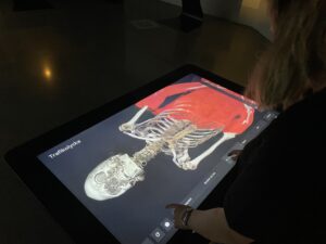 Person använder skärm som illustrerar kroppen efter en trafikolycka